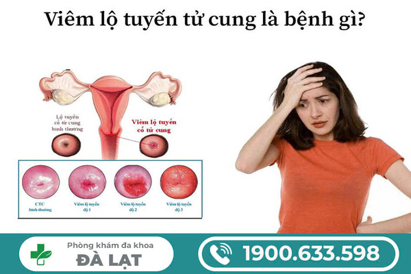 Hình ảnh minh họa