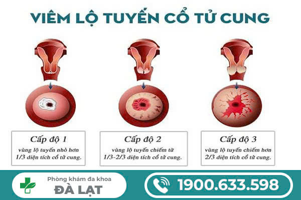 Hình ảnh minh họa