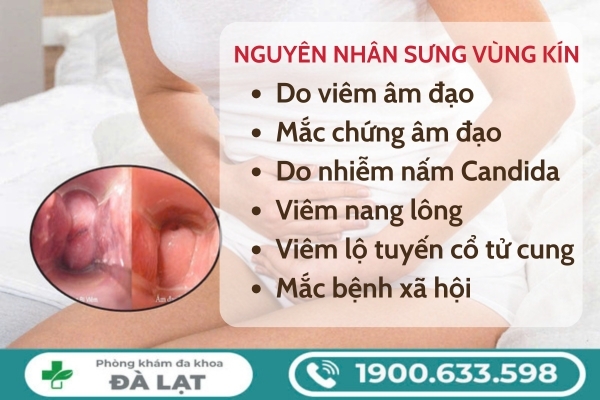 Hình ảnh minh họa