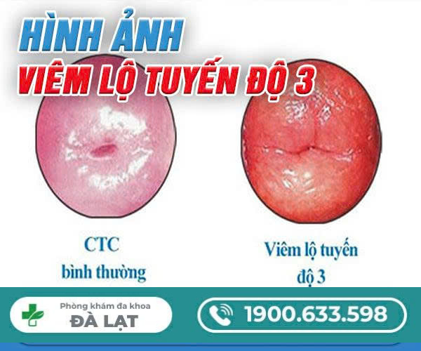 Hình ảnh minh họa