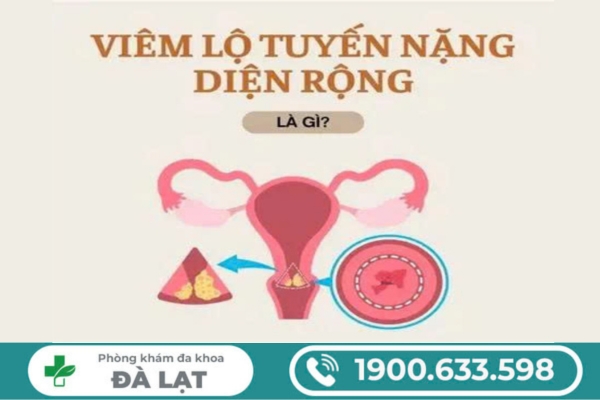 Hình ảnh minh họa