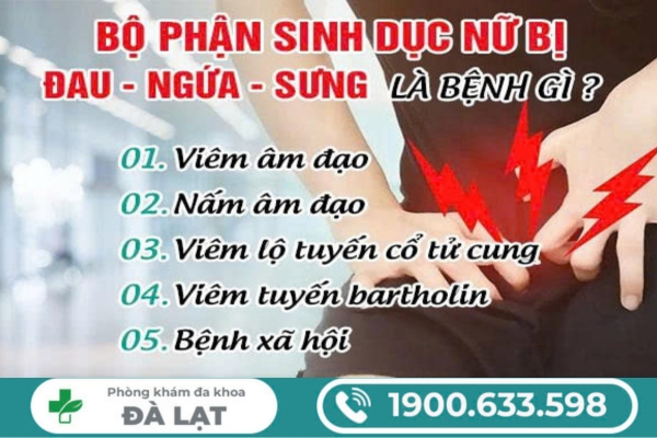 Hình ảnh minh họa