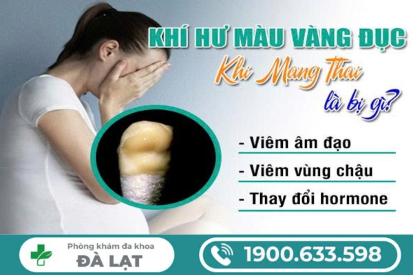 Hình ảnh minh họa