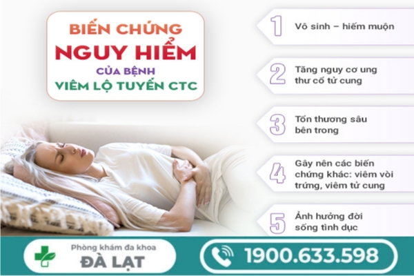 Hình ảnh minh họa