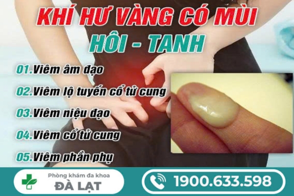 Hình ảnh minh họa