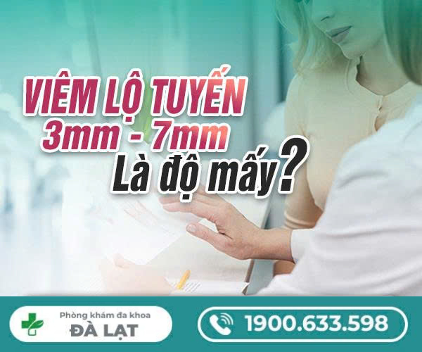 Hình ảnh minh họa