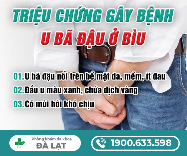 Hình ảnh minh họa